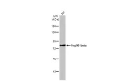 Anti-Hsp90 beta antibody [N2C2], Internal used in Western Blot (WB). GTX101423