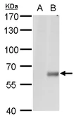 Anti-Copine 1 antibody [N1N3] used in Western Blot (WB). GTX101425