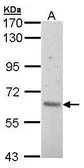 Anti-A-RAF antibody [C1C3] used in Western Blot (WB). GTX101427