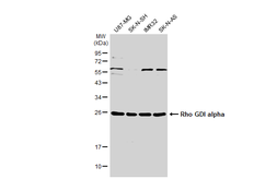 Anti-Rho GDI alpha antibody [N1C3] used in Western Blot (WB). GTX101428