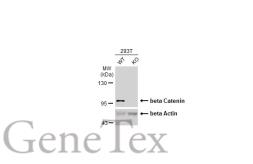 Anti-beta Catenin antibody [N1N2-2], N-term used in Western Blot (WB). GTX101435