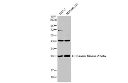 Anti-Casein Kinase 2 beta antibody used in Western Blot (WB). GTX101439
