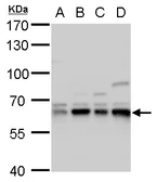 Anti-Copine 1 antibody [N3C3] used in Western Blot (WB). GTX101441