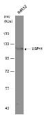 Anti-USP11 antibody [N1N2], N-term used in Western Blot (WB). GTX101446