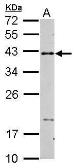 Anti-CD40 antibody used in Western Blot (WB). GTX101447