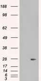 Anti-Pallidin antibody, C-term used in Western Blot (WB). GTX10145