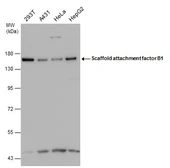 Anti-SAFB antibody used in Western Blot (WB). GTX101450