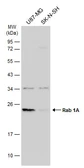 Anti-Rab 1A antibody [N1C3] used in Western Blot (WB). GTX101454