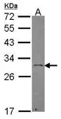 Anti-Ephrin A3 antibody [N1C3] used in Western Blot (WB). GTX101455