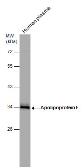 Anti-Apolipoprotein E antibody used in Western Blot (WB). GTX101456