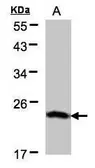 Anti-BTF3 antibody [N1C3] used in Western Blot (WB). GTX101462