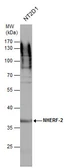 Anti-NHERF2 antibody [N2C3] used in Western Blot (WB). GTX101466