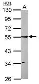 Anti-ARHGAP1 antibody [N3C3] used in Western Blot (WB). GTX101471