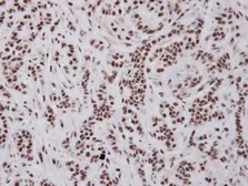 Anti-BAT1 antibody [N1C2] used in IHC (Paraffin sections) (IHC-P). GTX101475