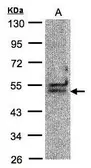 Anti-BAT1 antibody [C1C3] used in Western Blot (WB). GTX101476