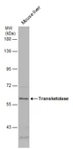 Anti-Transketolase antibody [N3C2], Internal used in Western Blot (WB). GTX101477