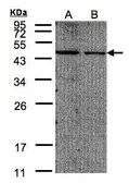 Anti-EIF4A2 antibody used in Western Blot (WB). GTX101485