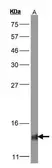 Anti-COX5B antibody [N1C3] used in Western Blot (WB). GTX101486