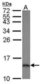 Anti-COX5A antibody [N1C3] used in Western Blot (WB). GTX101487