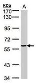 Anti-Tyrosyl tRNA synthetase antibody used in Western Blot (WB). GTX101492