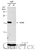 Anti-ENSA antibody used in Western Blot (WB). GTX101493