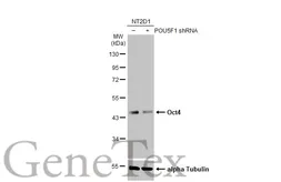 Anti-Oct4 antibody used in Western Blot (WB). GTX101497