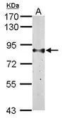 Anti-H6PD antibody [N2N3] used in Western Blot (WB). GTX101500