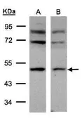 Anti-AP2M1 antibody used in Western Blot (WB). GTX101502