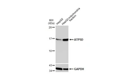Anti-ATP5D antibody used in Western Blot (WB). GTX101503