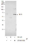 Anti-KLF4 antibody used in Immunoprecipitation (IP). GTX101508