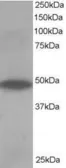 Anti-ORP1 antibody, C-term used in Western Blot (WB). GTX10151
