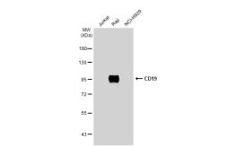 Anti-CD19 antibody [C1C3] used in Western Blot (WB). GTX101512