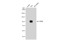 Anti-CD19 antibody [C1C3] used in Western Blot (WB). GTX101512