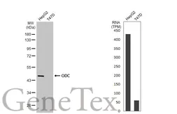 Anti-ODC antibody [N3C3] used in Western Blot (WB). GTX101521