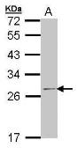 Anti-RPL14 antibody [N1C1] used in Western Blot (WB). GTX101524