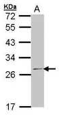 Anti-RPL14 antibody [N1C1] used in Western Blot (WB). GTX101524