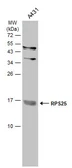 Anti-RPS25 antibody used in Western Blot (WB). GTX101526