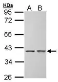 Anti-SGTA antibody used in Western Blot (WB). GTX101532