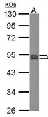 Anti-SEPT7 antibody [N3C3] used in Western Blot (WB). GTX101533