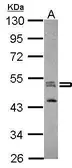 Anti-SEPT7 antibody [N1C1] used in Western Blot (WB). GTX101534