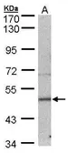 Anti-SEPT7 antibody [N1C1] used in Western Blot (WB). GTX101534