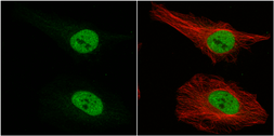 Anti-Musashi 1 antibody [N3C3] used in Immunocytochemistry/ Immunofluorescence (ICC/IF). GTX101540