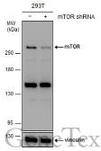 Anti-mTOR antibody [C1], Internal used in Western Blot (WB). GTX101558