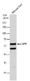 Anti-GPT antibody [N1N3] used in Western Blot (WB). GTX101559