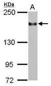 Anti-CD11a antibody [C1C2], Internal used in Western Blot (WB). GTX101564