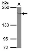 Anti-CD11a antibody [N2N3] used in Western Blot (WB). GTX101565