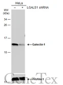 Anti-Galectin 1 antibody used in Western Blot (WB). GTX101566