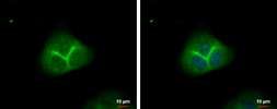 Anti-alpha Adducin antibody used in Immunocytochemistry/ Immunofluorescence (ICC/IF). GTX101574