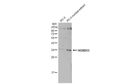 Anti-HOXB13 antibody [N1C2] used in Western Blot (WB). GTX101576