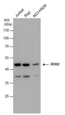 Anti-DOK2 antibody [N1C1] used in Western Blot (WB). GTX101577